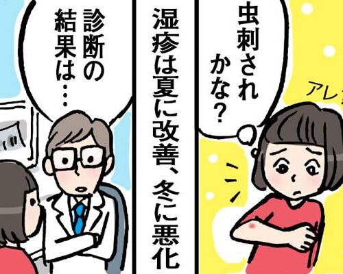 夏は改善して冬に悪化を繰り返す湿疹