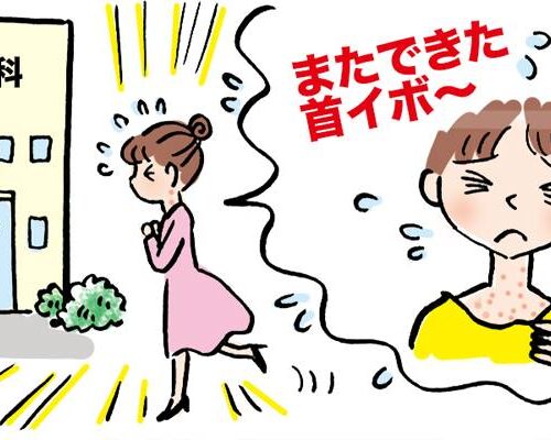 首元に大量発生のイボ