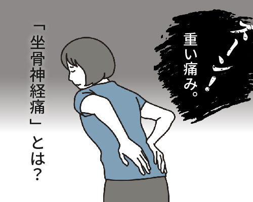 坐骨神経痛の女性