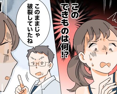 「何これ！？左肩にゴルフボールほどのできものが…」恐怖と驚きの受診結果は【体験談】