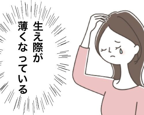 薄毛イメージ