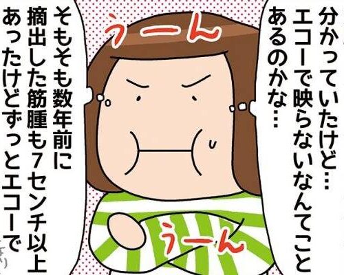 人間ドックで指摘された子宮筋腫 3