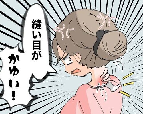 衣類のタグや縫い目がかゆい女性