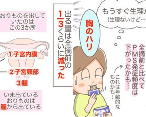 子宮を全摘したらどんな感じ？