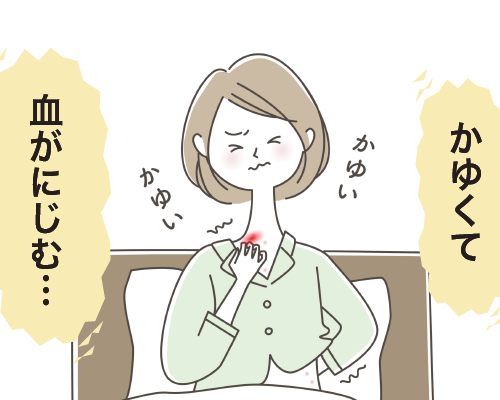 かゆみがひどい女性