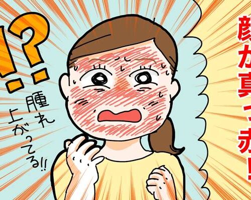 突然、顔が真っ赤に腫れ上がり…40代で起こった頑固な肌荒れで生活習慣を見直し【体験談】