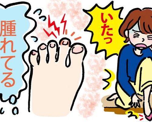 爪が皮膚に食い込んで痛い！ 突然の痛みと腫れを引き起こした思わぬ原因は【体験談】