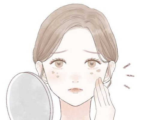 シミがある女性のイラスト