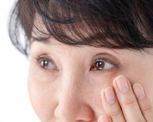 目元のたるみが気になる女性のイメージ