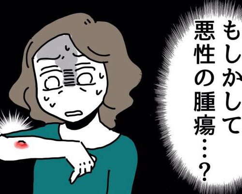 右腕のじんましん（虫刺されのようなもの）を見て「もしかして悪性の腫瘍？」と不安がる女性のイラスト
