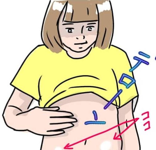 娘の尋常性白斑／フワリー