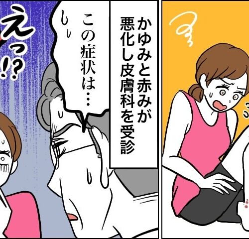 かかとの近くに謎のボツボツができた女性