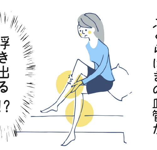 ふくらはぎを気にする女性