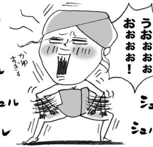 入浴後に発生する我慢できないかゆみ！ 病院で診断されたのは【体験談】