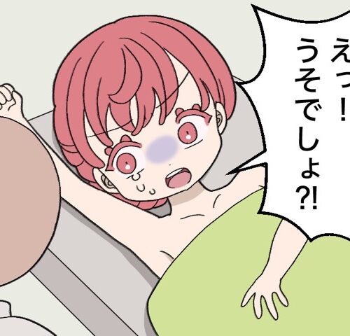 脱毛施術中に痛みに驚いて目を見開く女性のイラスト