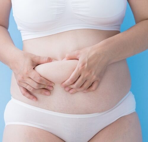「知らなかった！」40代のぽっこりおなか、肥満だけが原因じゃなかった！ 原因は一体何？【医師監修】