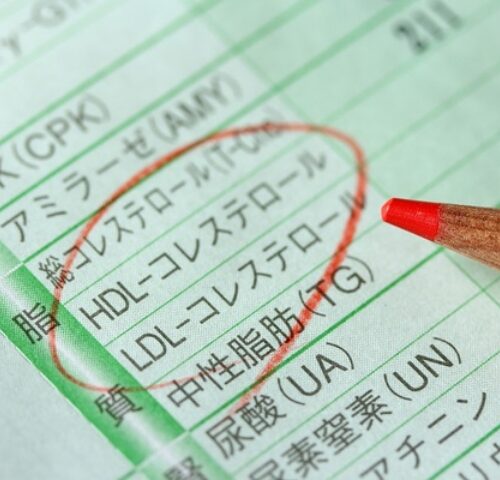 更年期に「LDLコレステロール」はなぜ増える？ 動脈硬化などのリスクが上昇！ 対策は？【医師監修】
