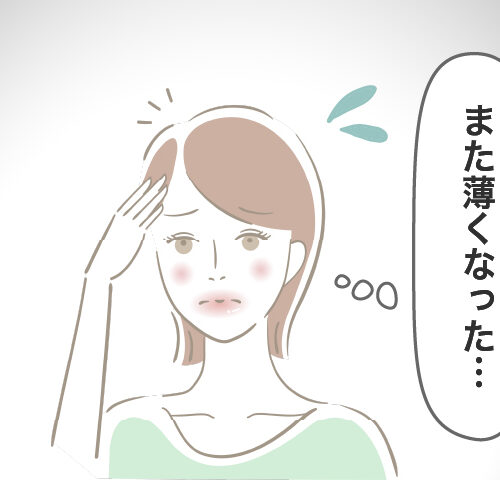 抜け毛を気にする女性