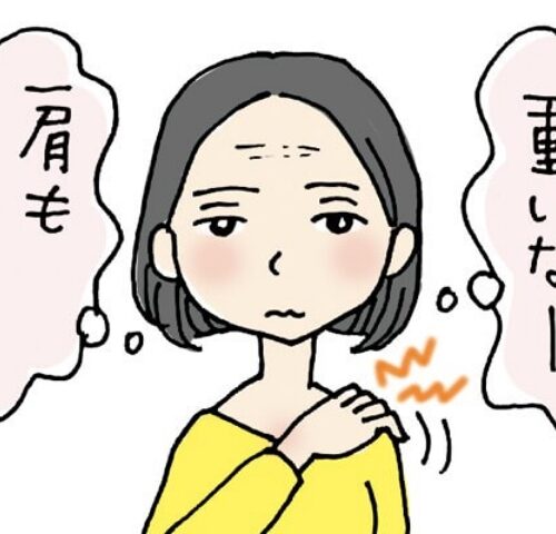 眼瞼下垂の女性