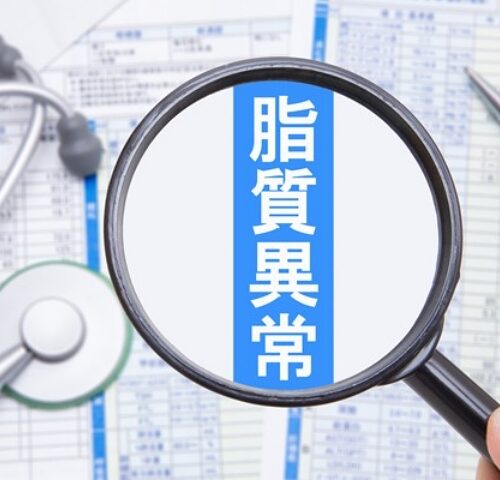 え？ 閉経後は「総コレステロール値が2倍」にも！？ 今すぐできる食生活改善とは【医師監修】