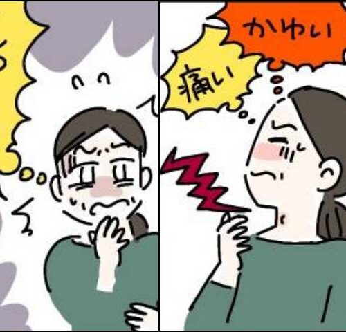 粉瘤ができた女性