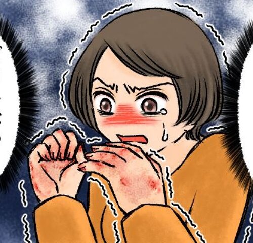手の甲が割れ、痛くてたまらない！ なかなか治らないひどい手荒れ、皮膚科で診断されたのは【体験談】