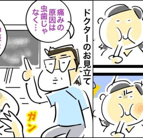 銀歯の下の悲劇
