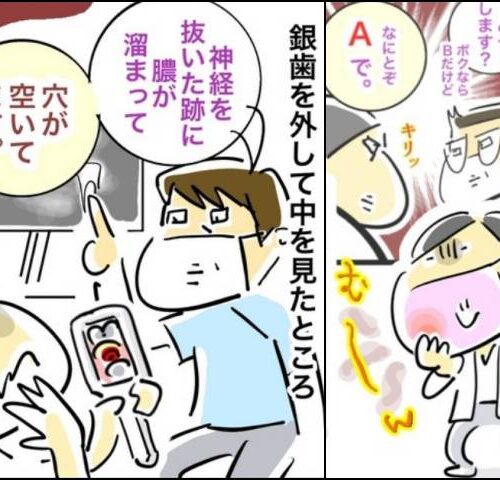 銀歯の下の悲劇／へそ