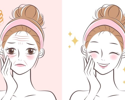 おでこの横ジワ解消