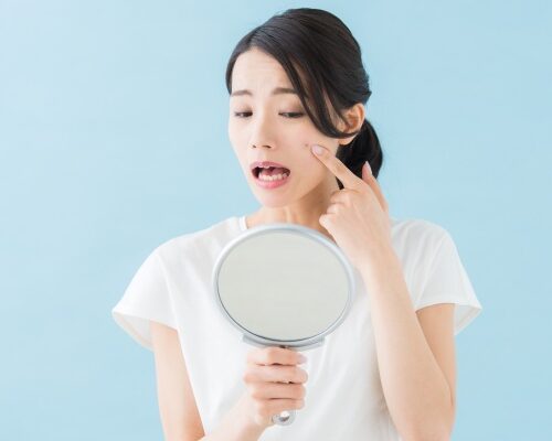 シミが気になる女性