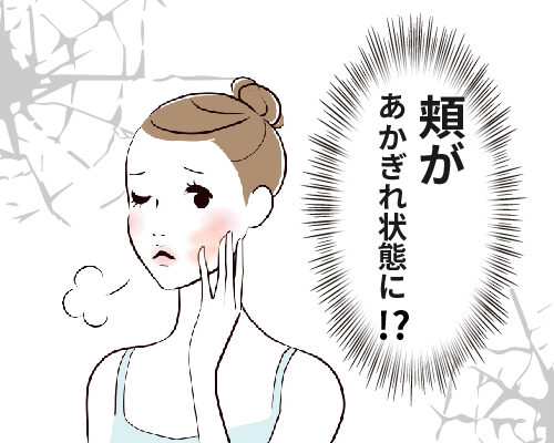 頬の乾燥に悩む女性