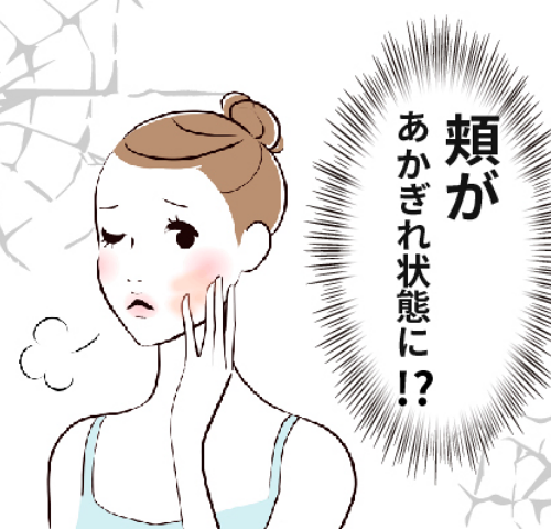 頬の乾燥に悩む女性