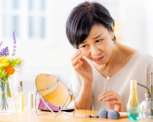 女性　シミ　肝斑